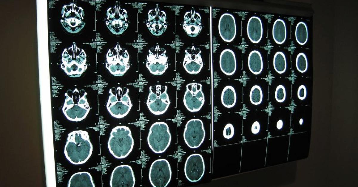 Living With And Recovering From A Traumatic Brain Injury | Wisconsin