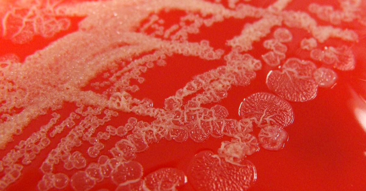 a crash course in elizabethkingia the rare bacterial elizabethkingia meningoseptica