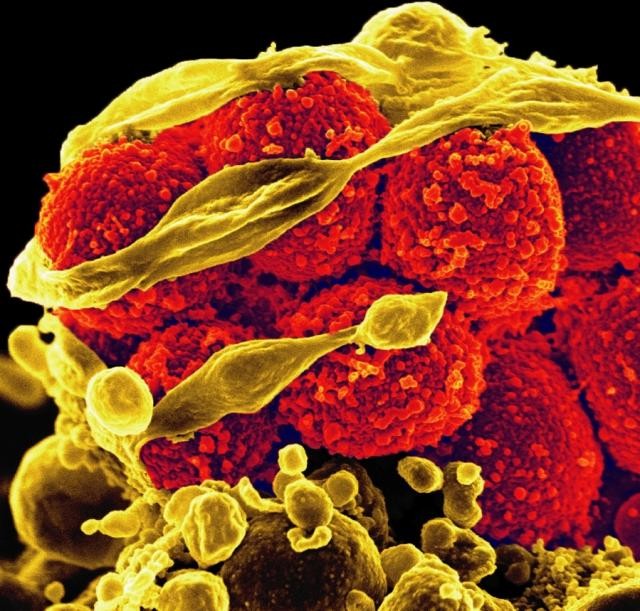 staphylococcus laboratory staphylococcus laboratory